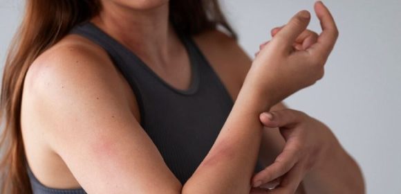 7 Obat Alami yang Menjaga Kulit, Bikin Keluarga Makin Sehat dan Anak Berprestasi! 7 Obat Alami yang Menjaga Kulit, Bikin Keluarga Makin Sehat dan Anak Berprestasi!